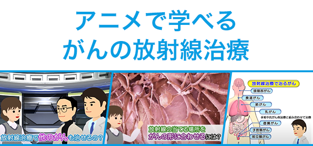 アニメで学べるがんの放射線治療
