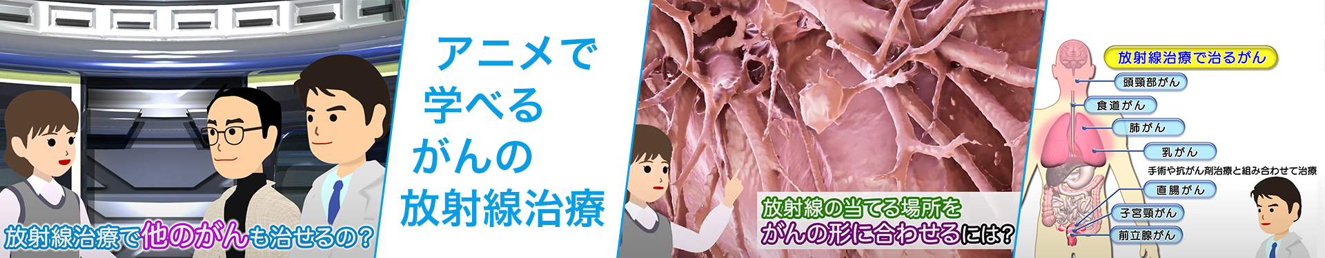 アニメで学べるがんの放射線治療